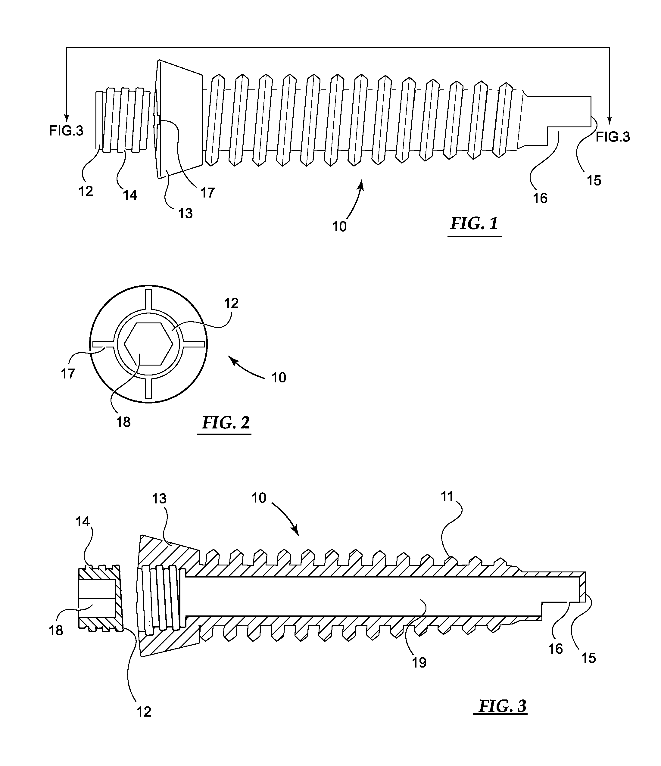 Device and method for orthopedic fracture fixation