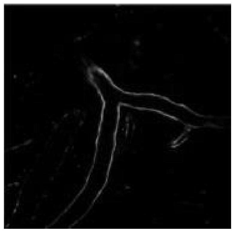 Thrombolytic efficacy evaluation method based on two-photon microscope technology