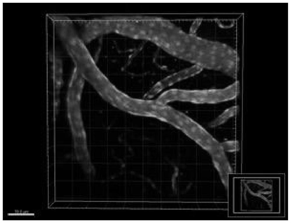 Thrombolytic efficacy evaluation method based on two-photon microscope technology