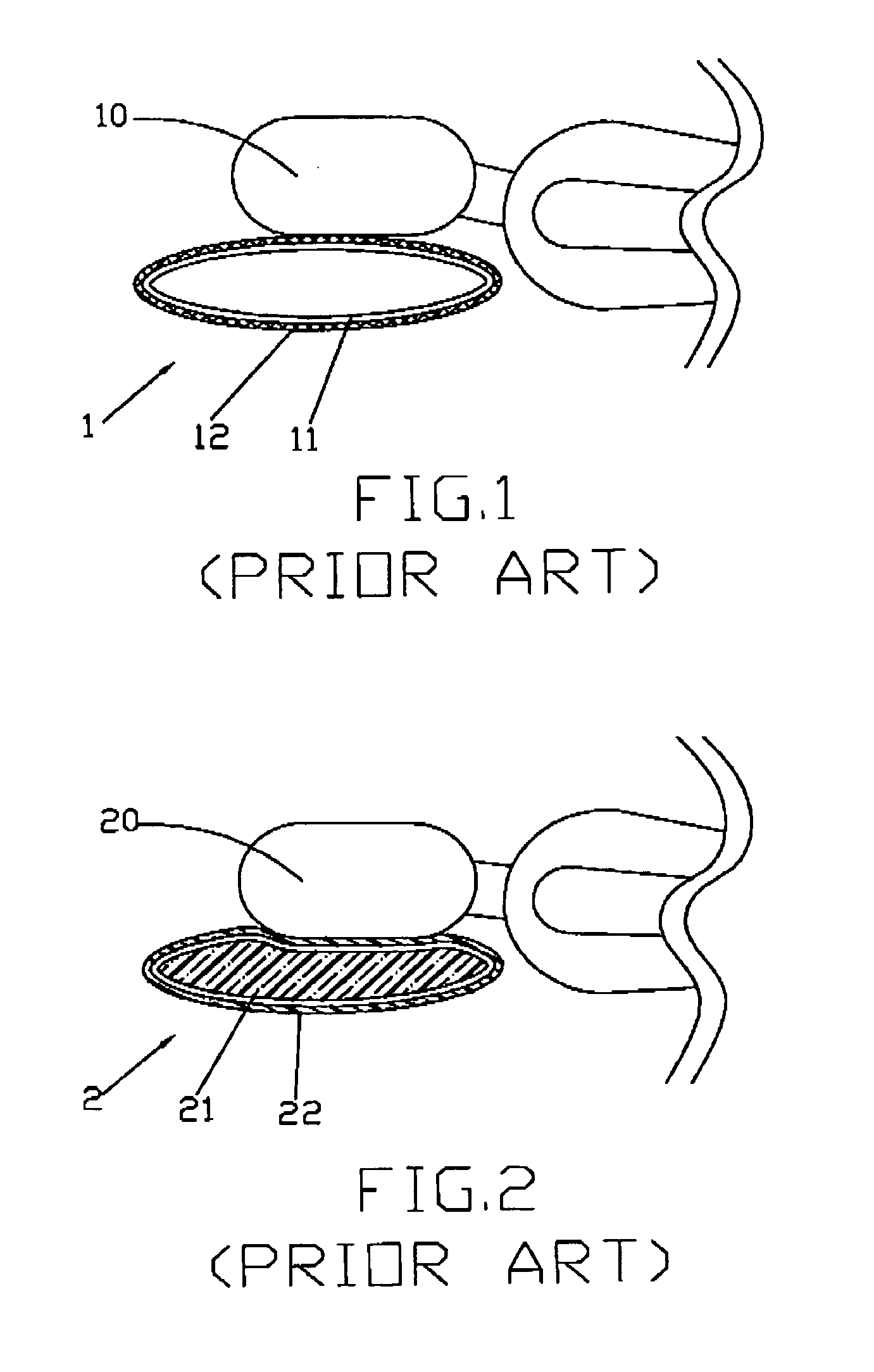 Replaceable bedding structure