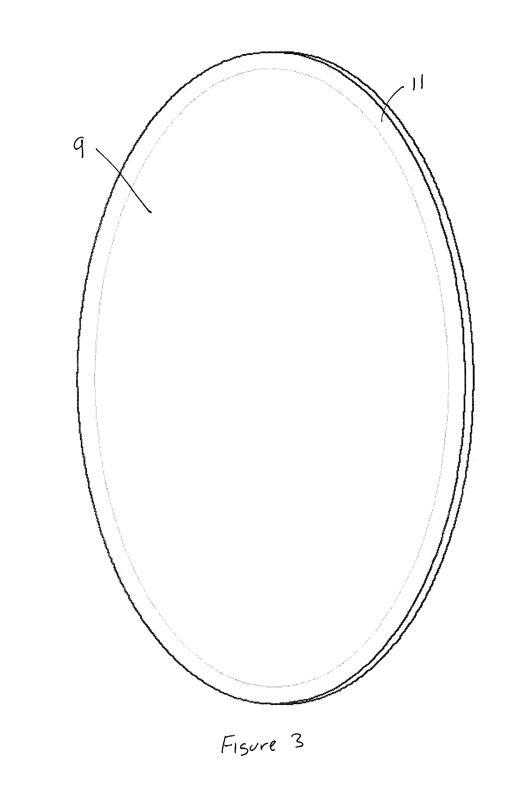 Reflector antenna radome with backlobe suppressor ring and method of manufacturing