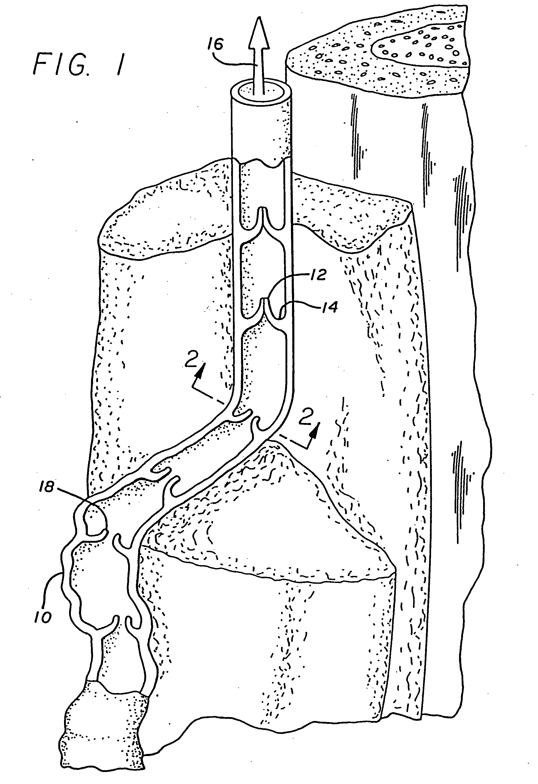 Method for treating venous insufficiency using directionally applied energy