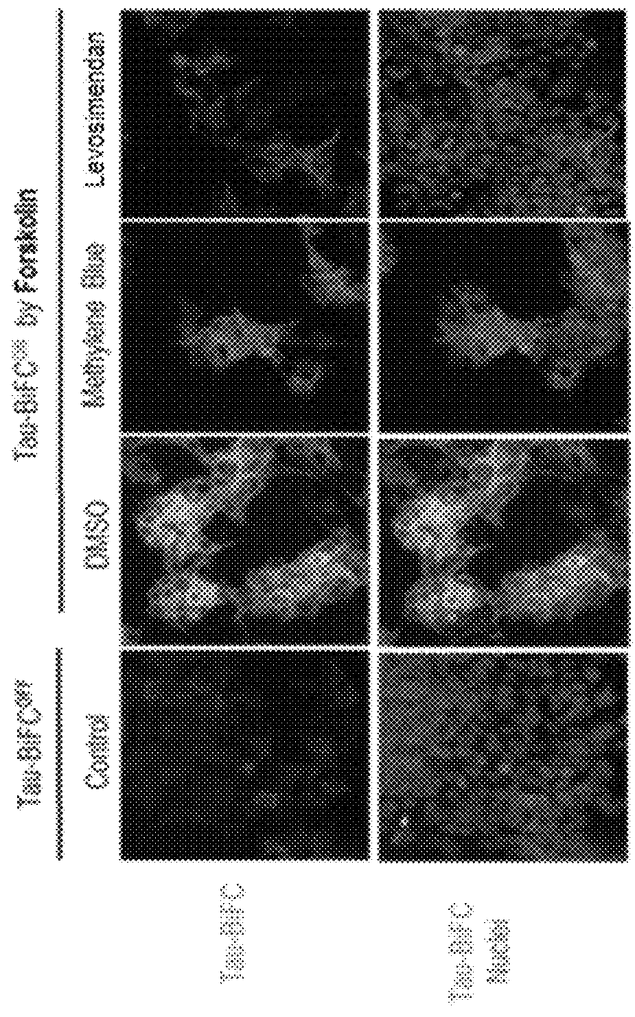 Levosimendan compound for preventing or treating tau-related diseases