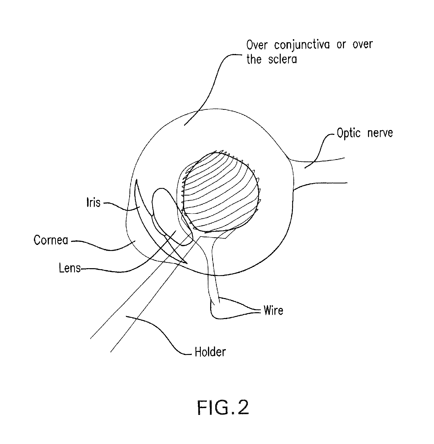 Method and composition for hyperthermally treating cells