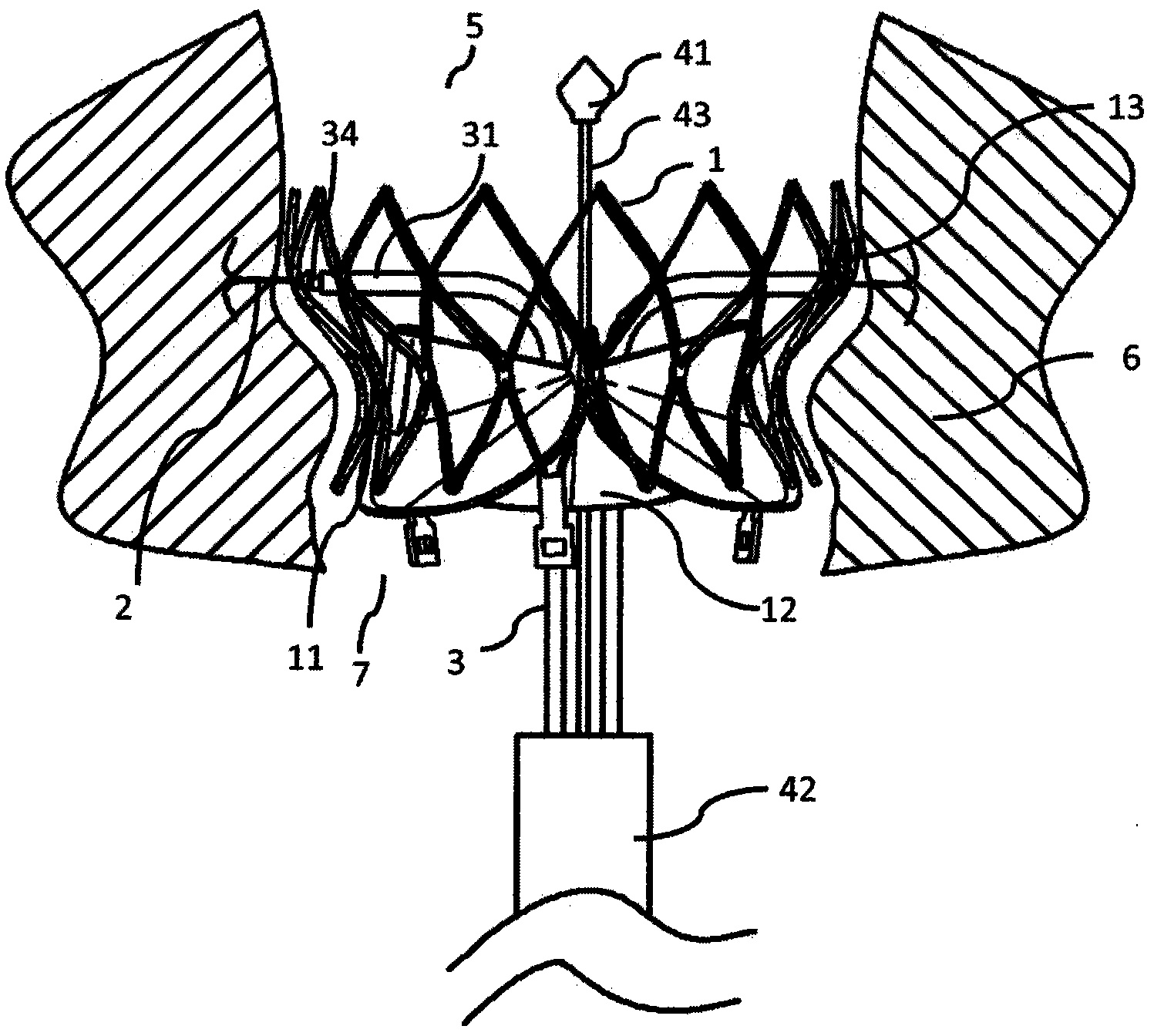 Novel cardiac valve implantation instrument with anchoring device