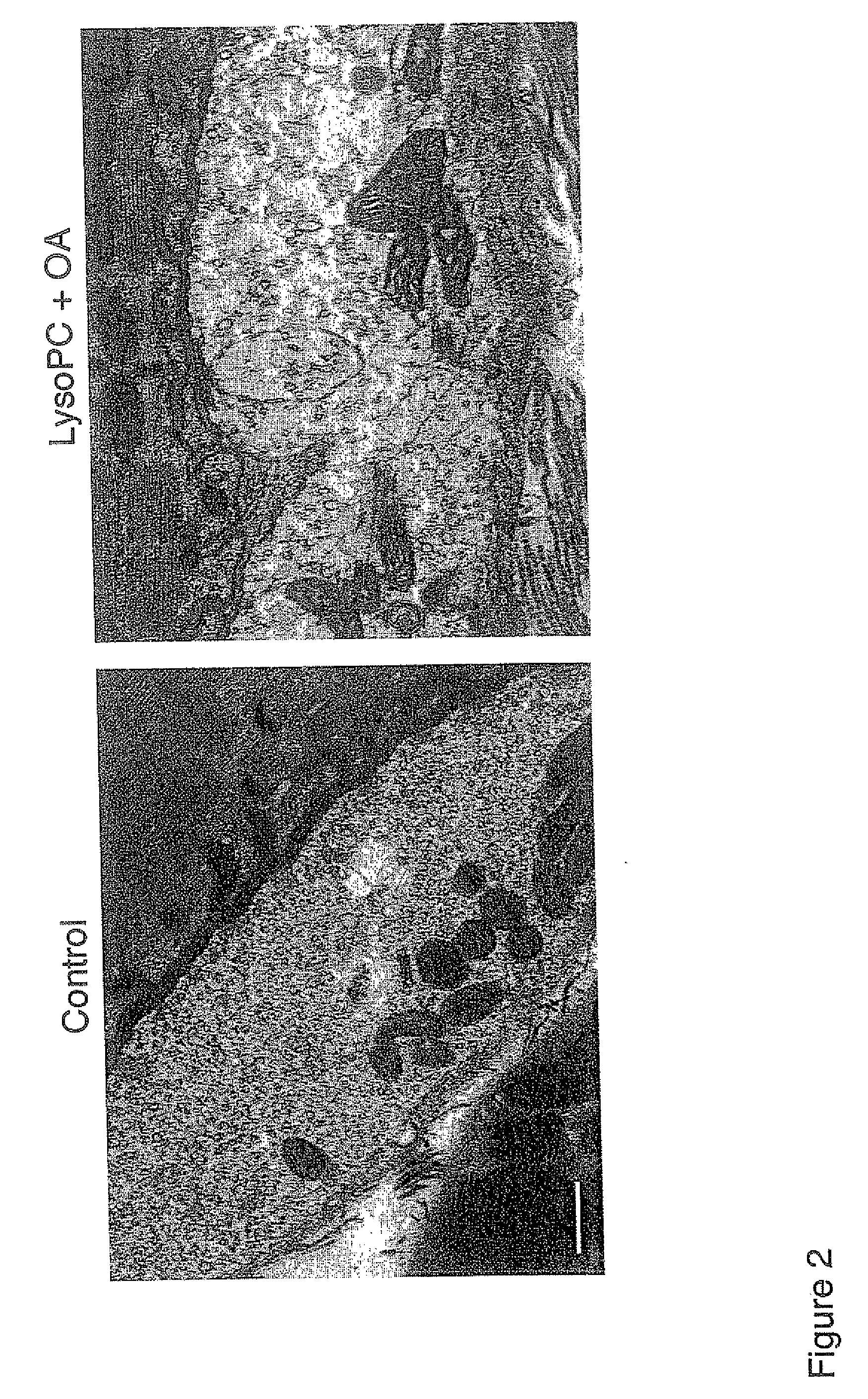 Products for topical application comprising lysophospholipids and fatty acids