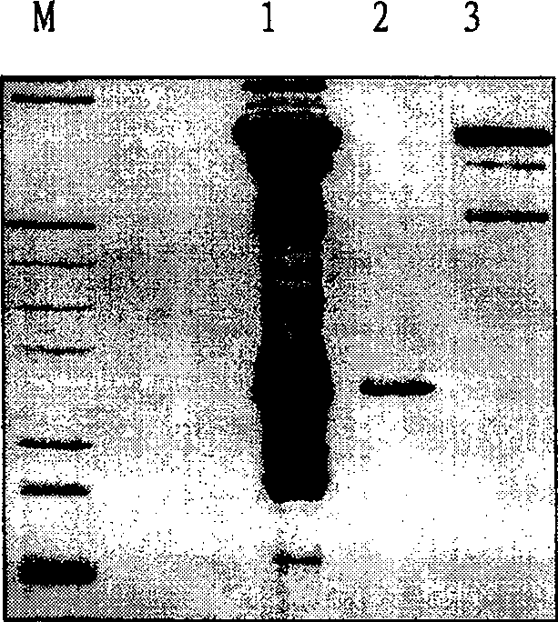 HAb18Gedomab 1 monoclonal antibody and light and heavy chain variable area genes, coding polypeptide and use