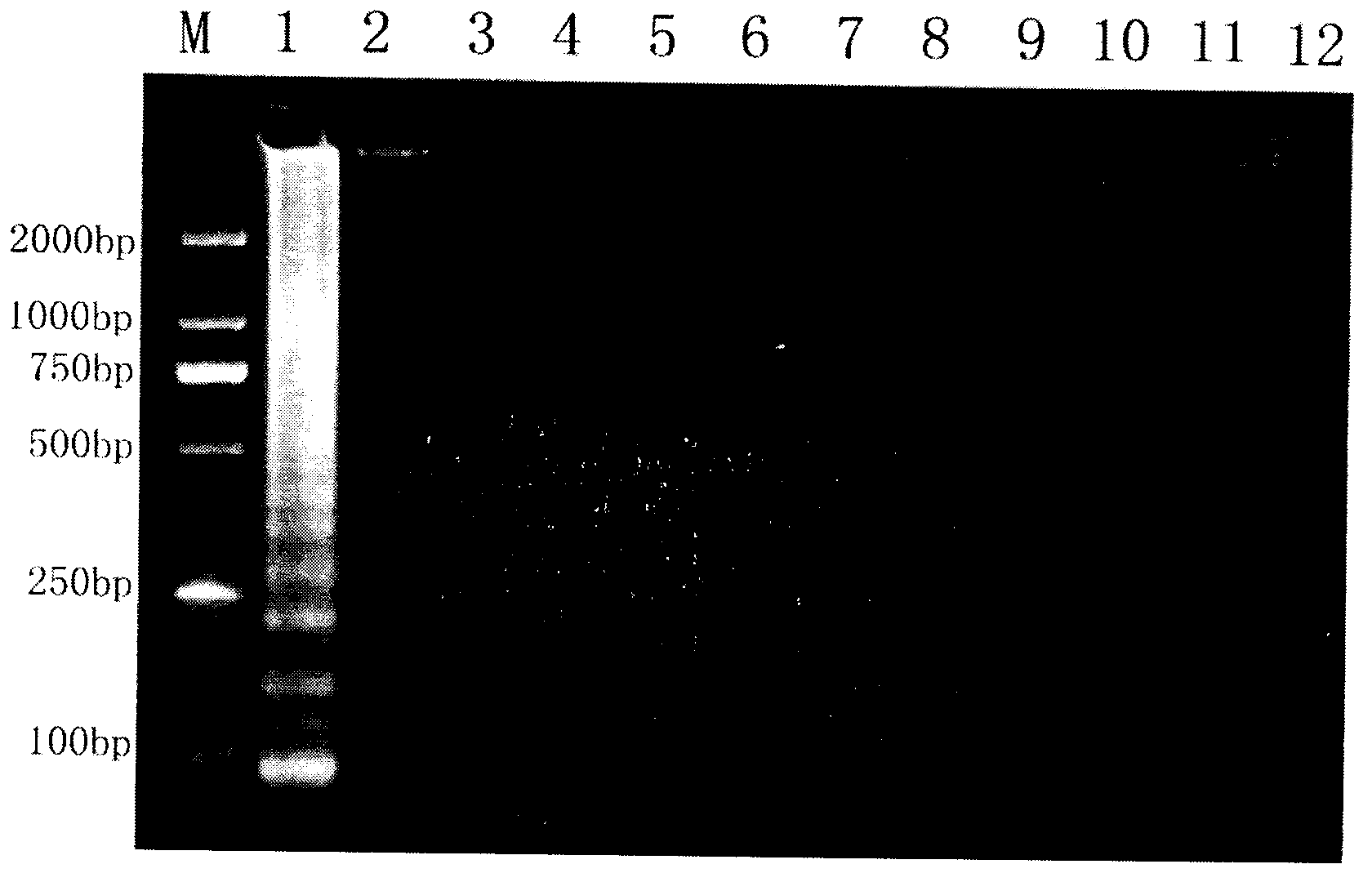 Actinobacillus pleuropneumoniae LAMP kit and application method thereof