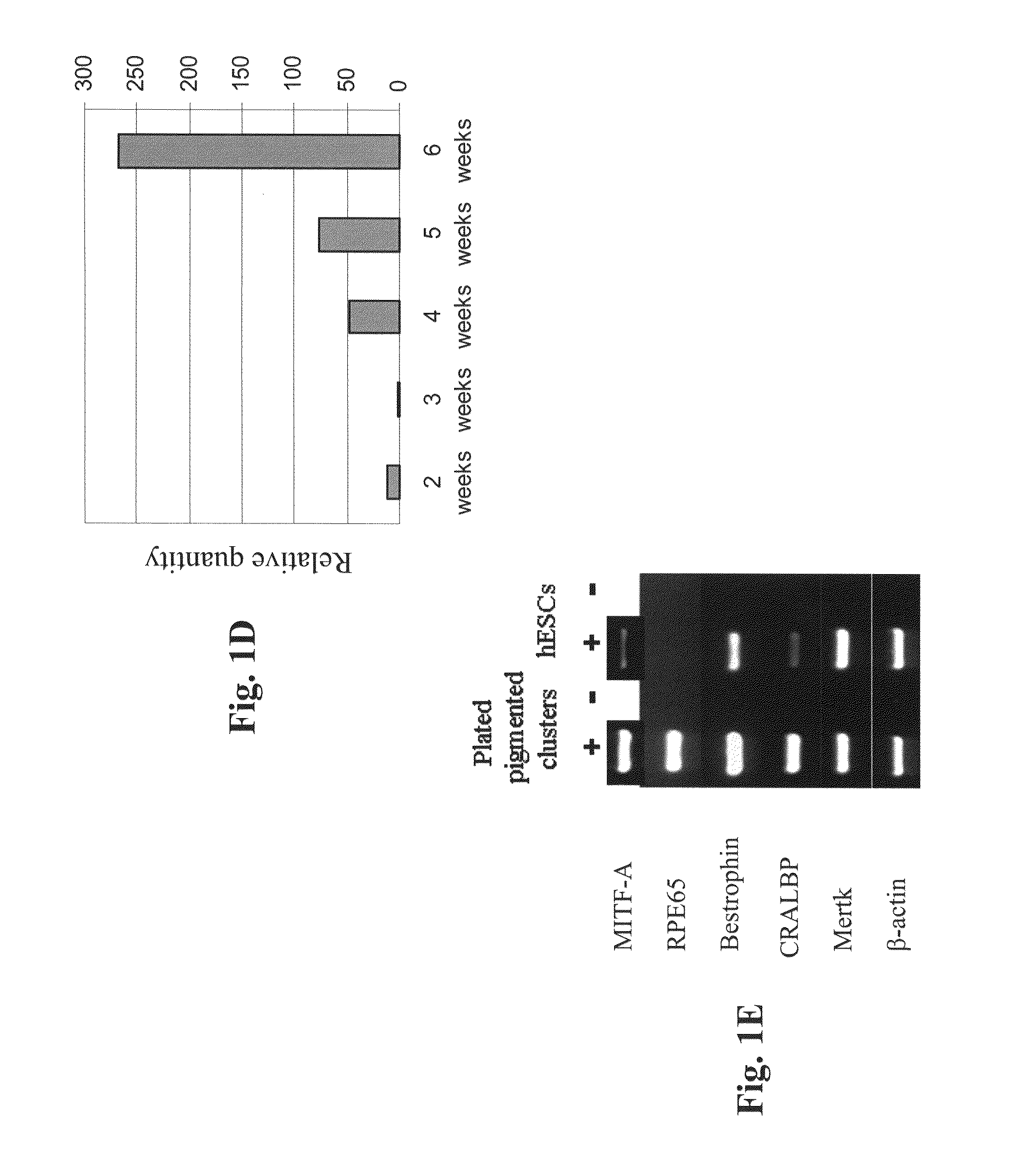 Retinal pigment epithelial cells differentiated from embryonic stem cells with nicotinamide and activin A