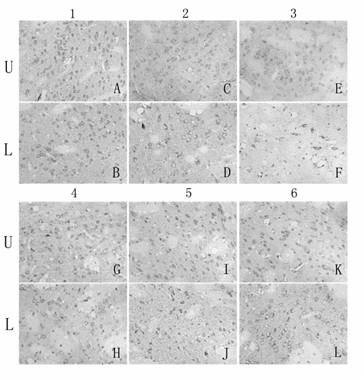 Application of Chinese medicinal composition in preparing medicament for preventing and treating Parkinsonism