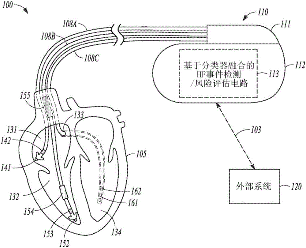 Heart failure event prediction using classifier fusion