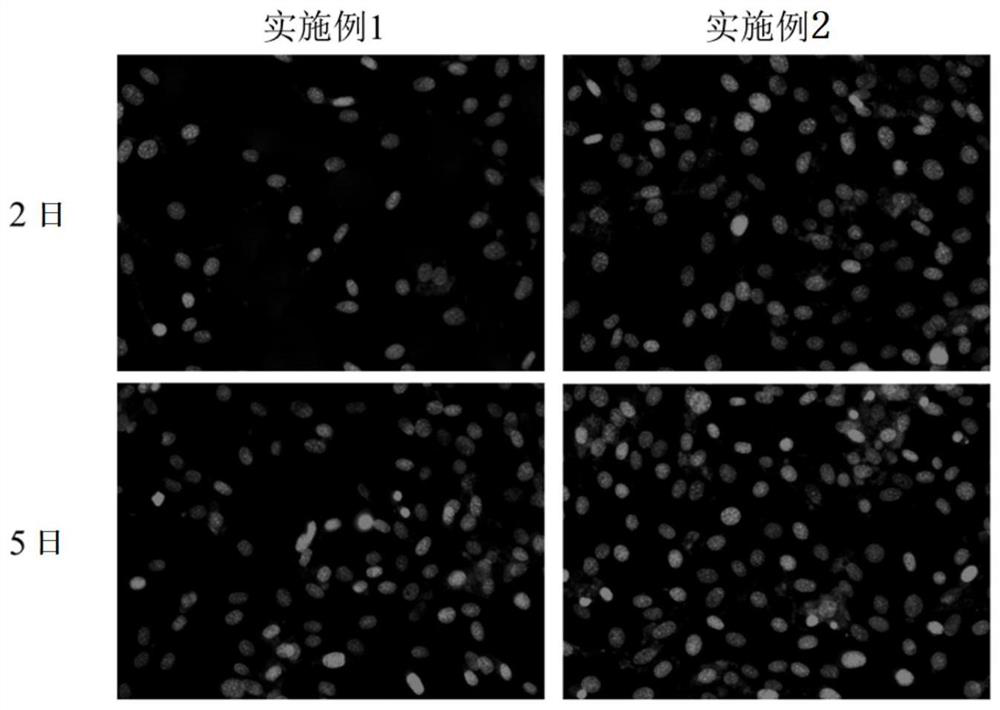 A degradable, anti-adhesion double-layer dura mater patch and its preparation method