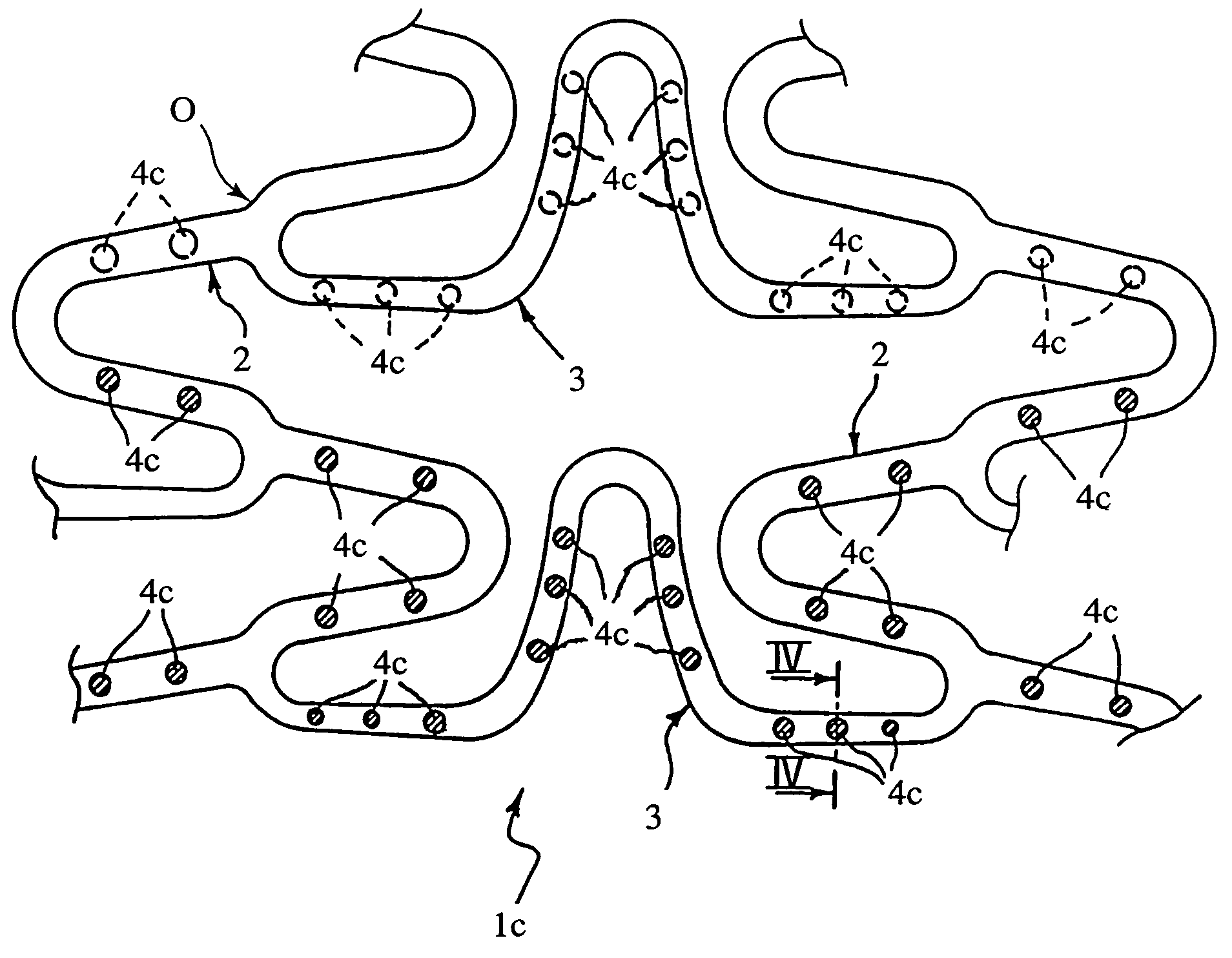 Angioplasty stents