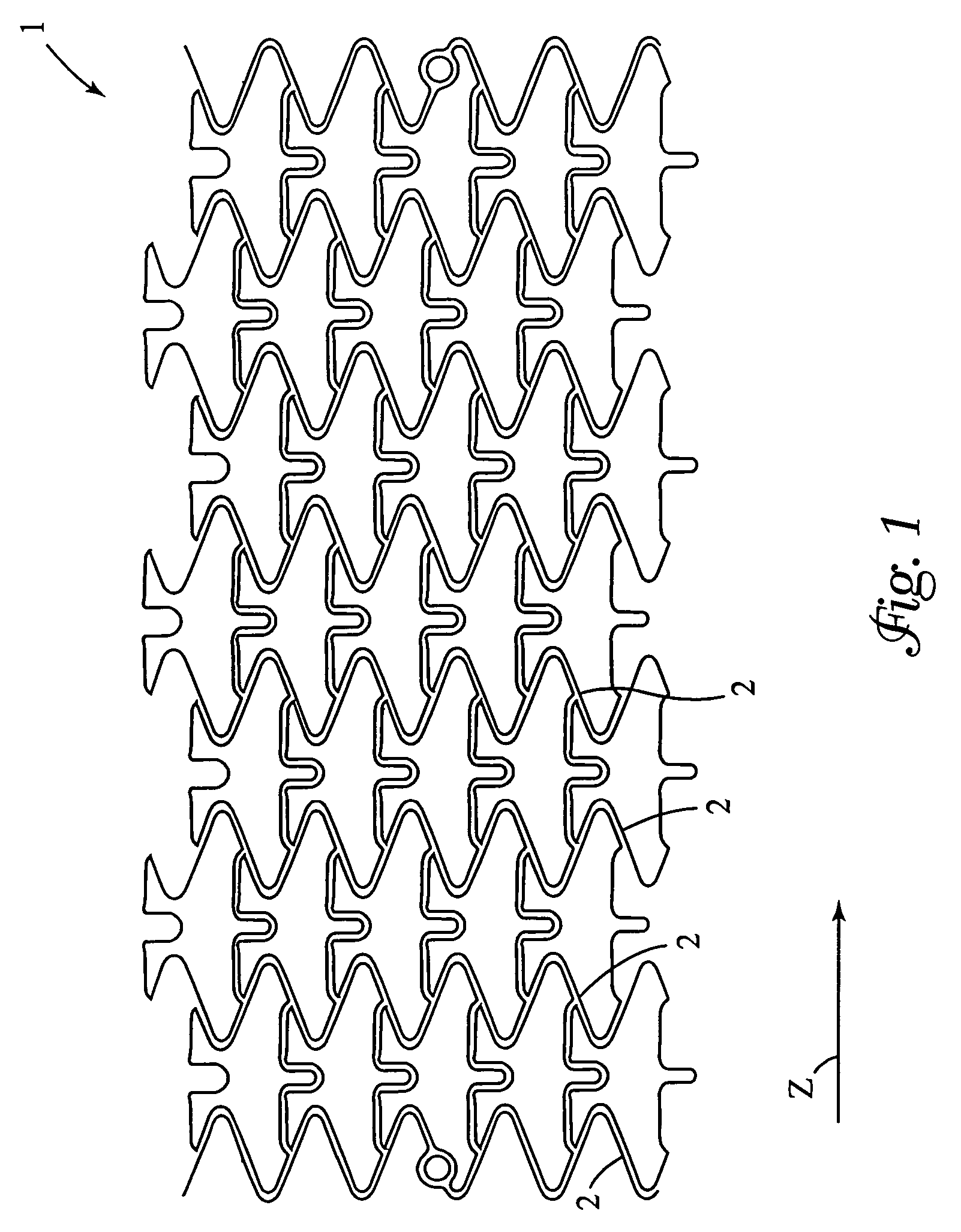 Angioplasty stents