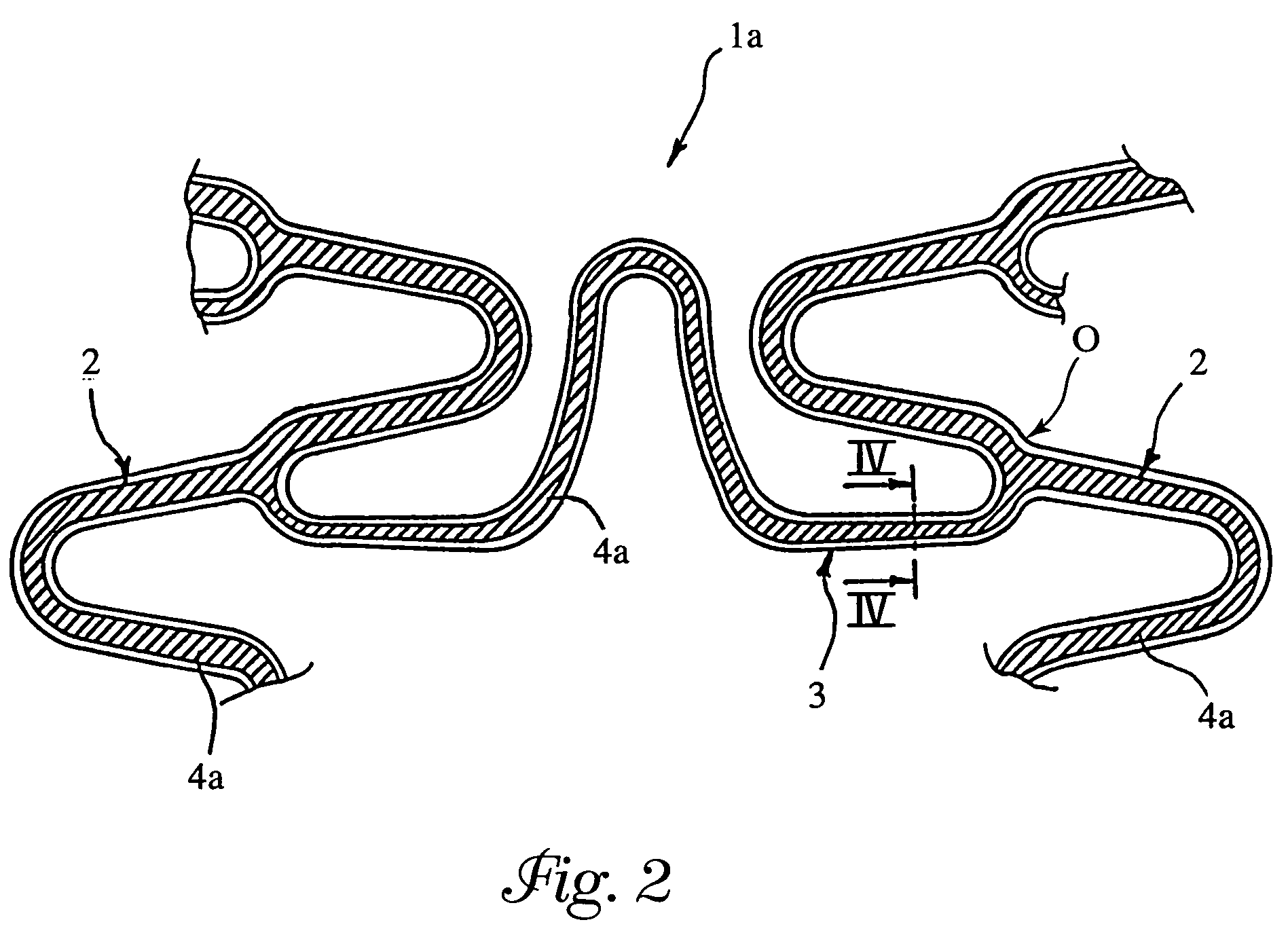 Angioplasty stents