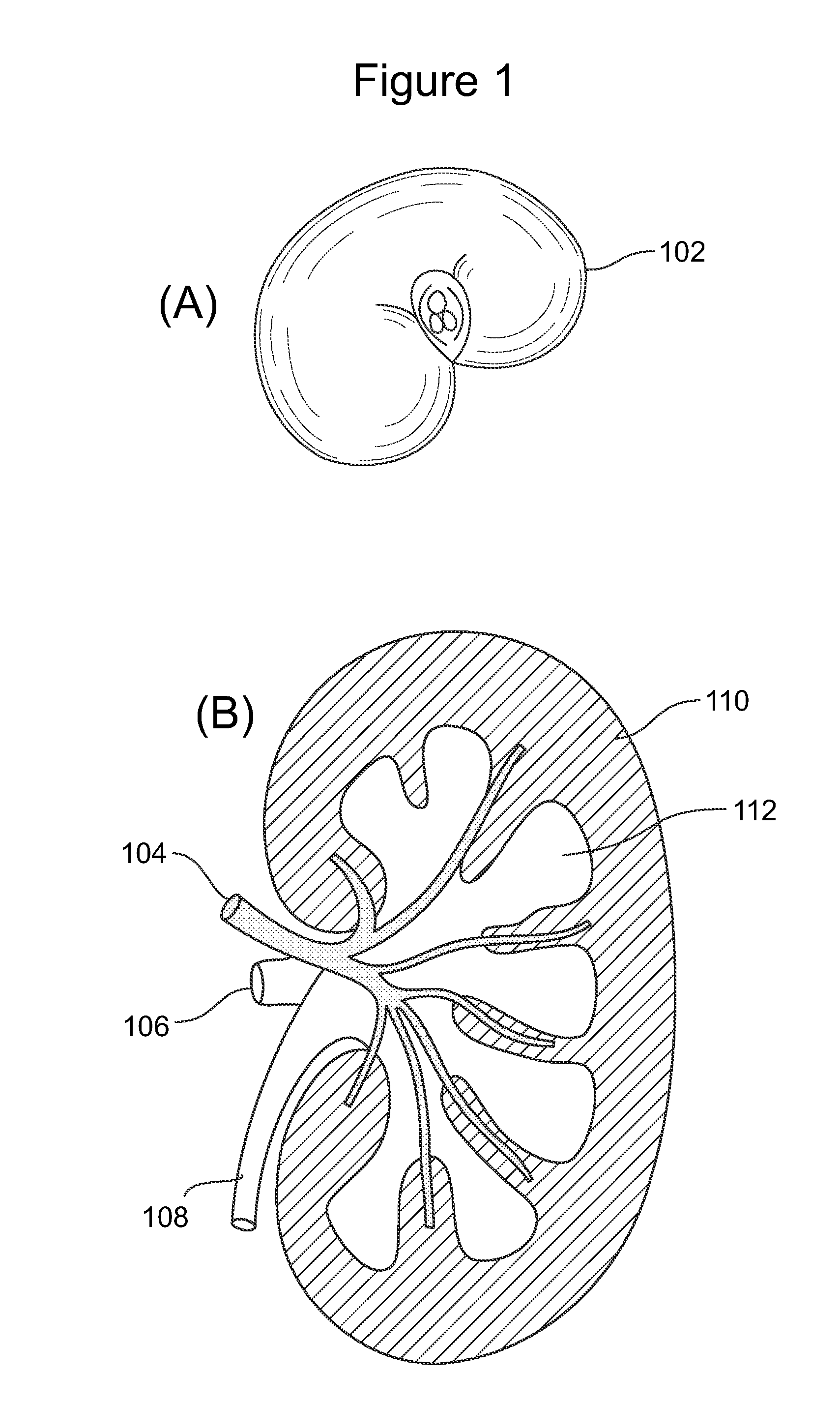 Method and system for quantitative renal assessment