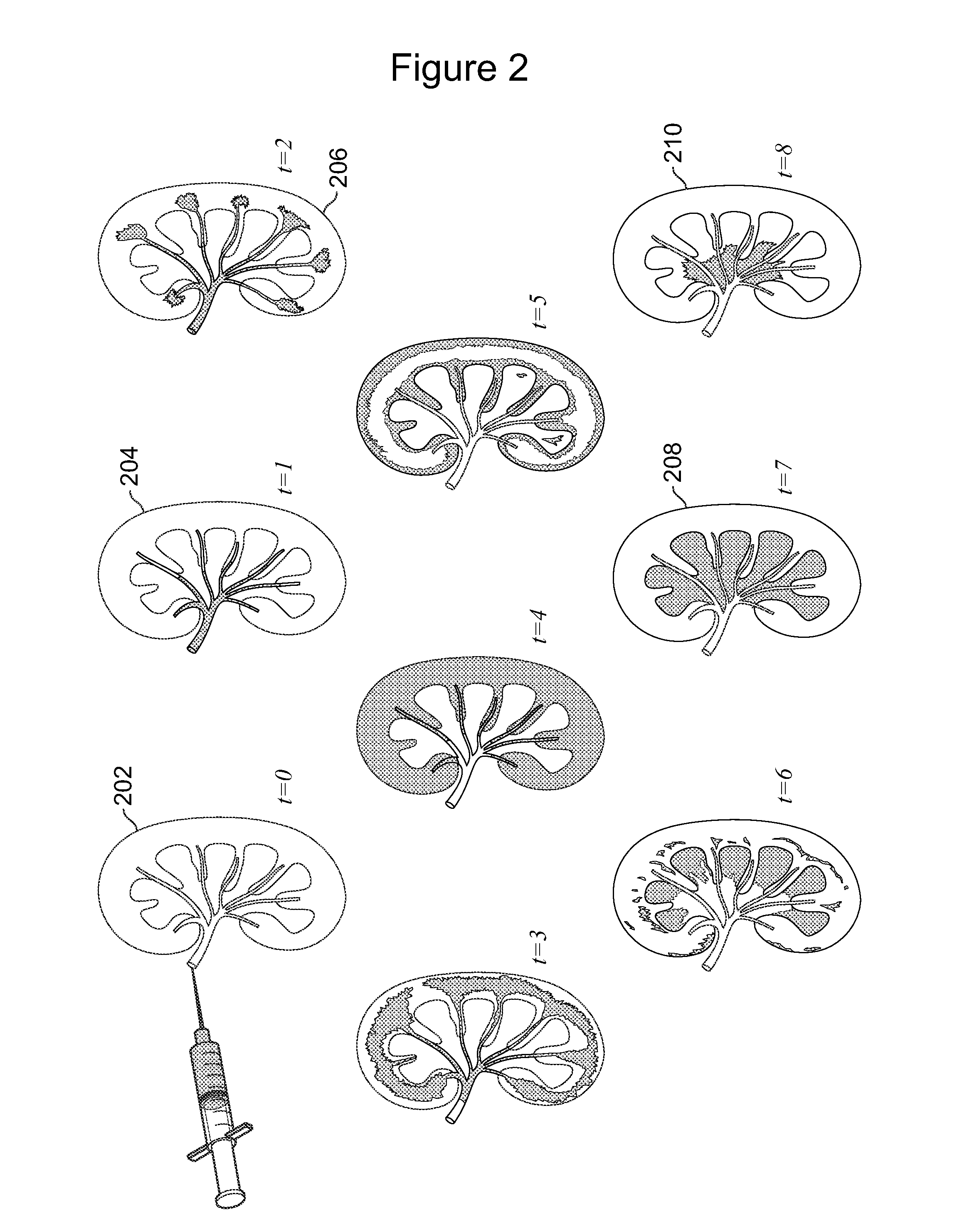 Method and system for quantitative renal assessment