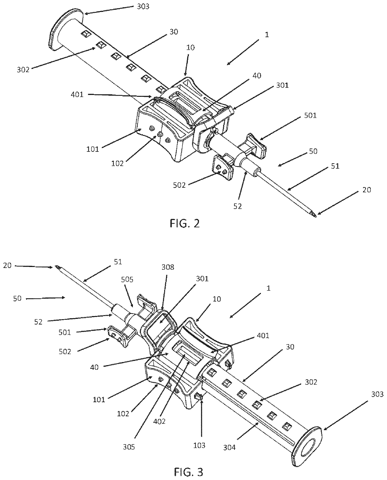 Intravenous access assist device with safety feature