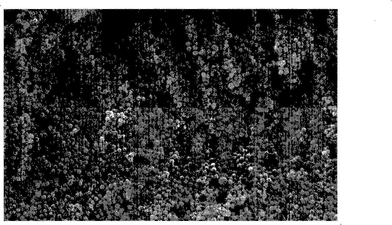 Implantation type antineoplastic drug of 10-hydroxycamptothecin dual-sustained-release particle formulation and preparation method thereof