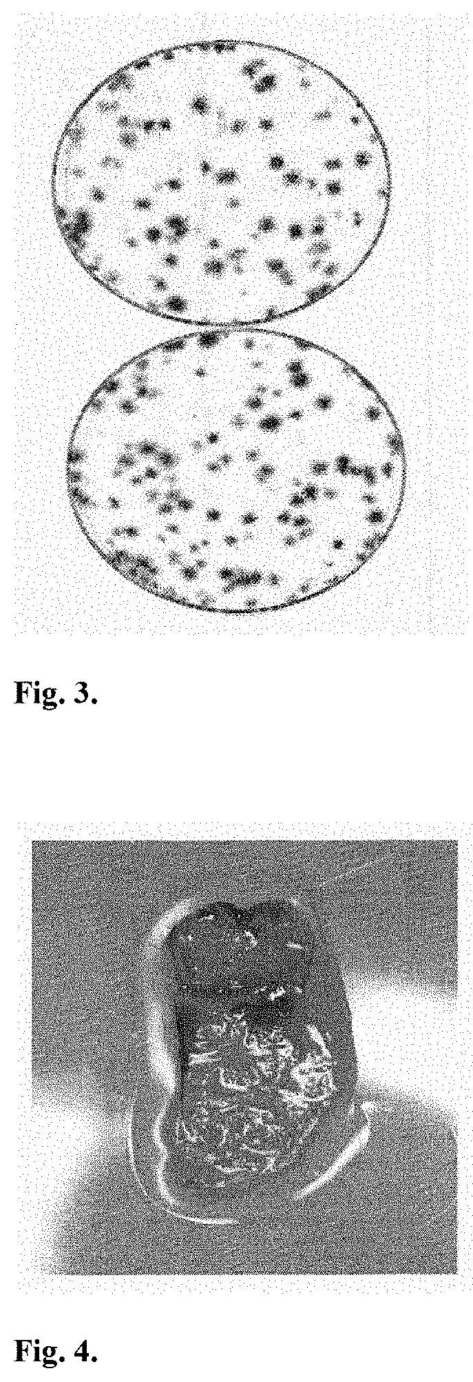 Biotransplant for treating gum recession and restoring gingival tissue volume