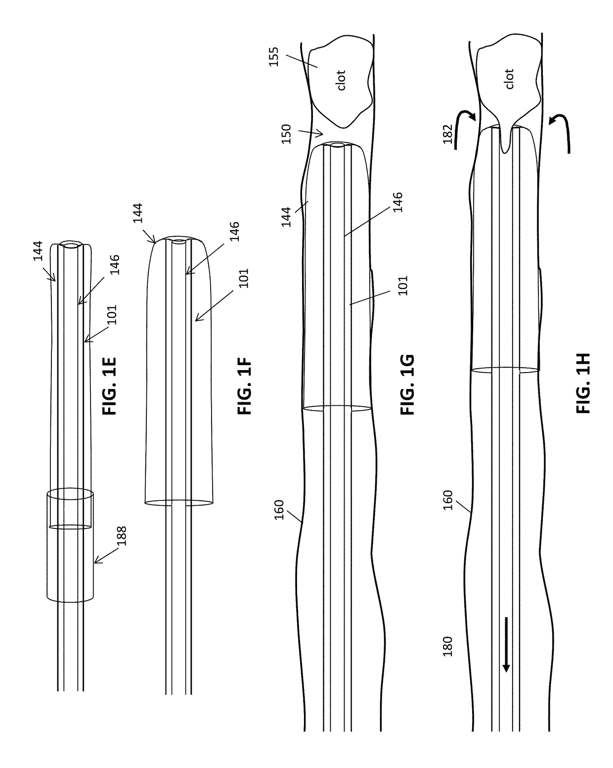 Pre-loaded inverting tractor thrombectomy apparatuses and methods