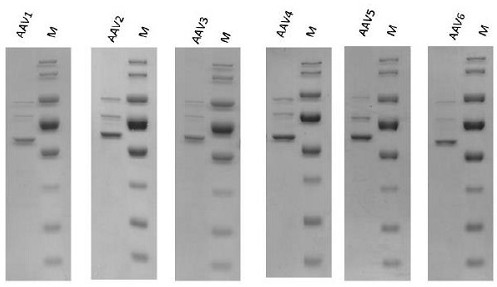 Separation and purification method of adeno-associated virus