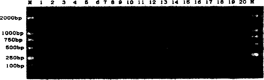 Detecting gene of bacillus anthracis anticarbendazol and its reagent box