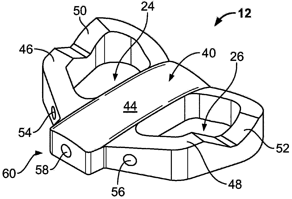 Spinal implant, instrument for preparation and method of use