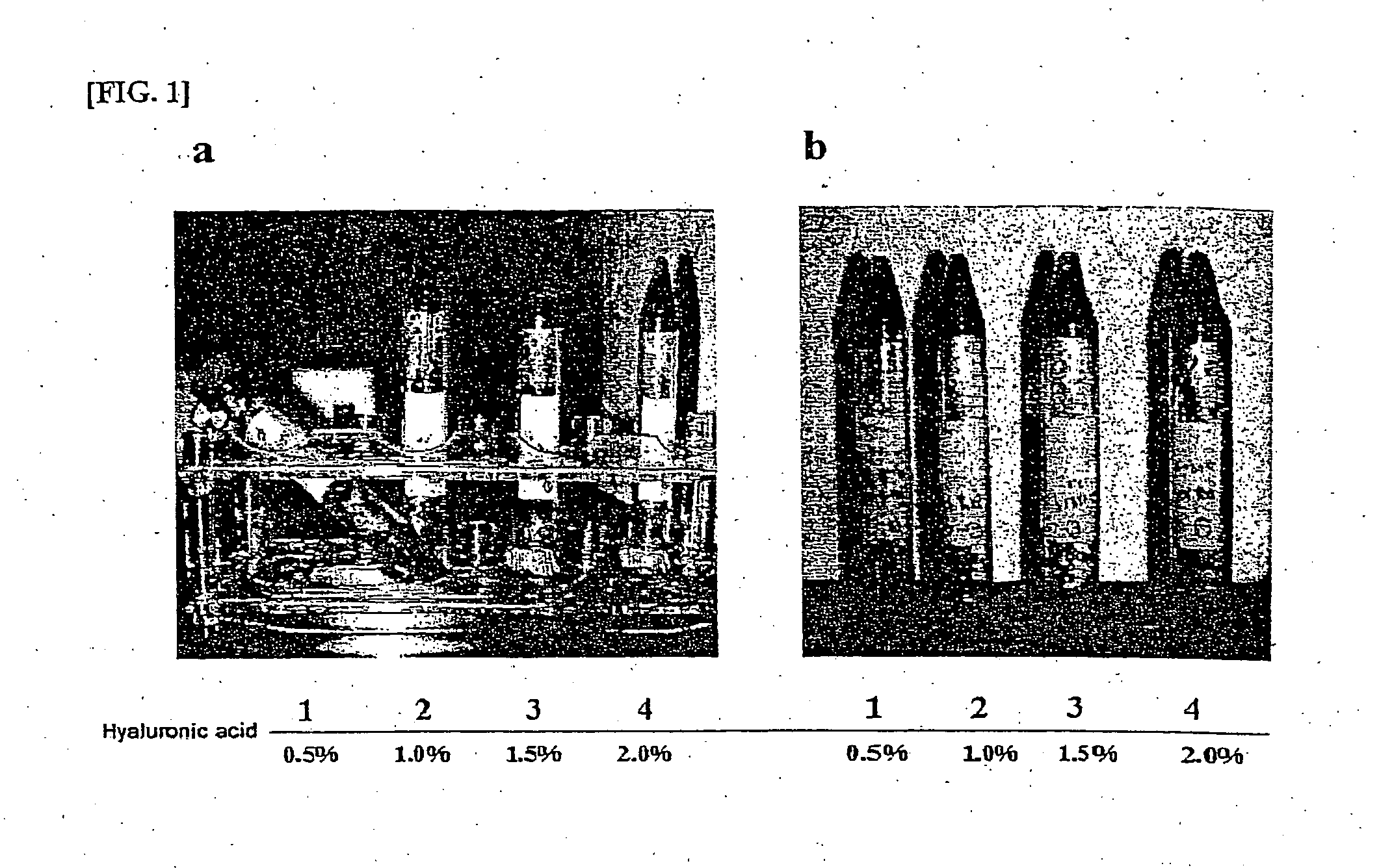 Composition for treatment of articular cartilage damage