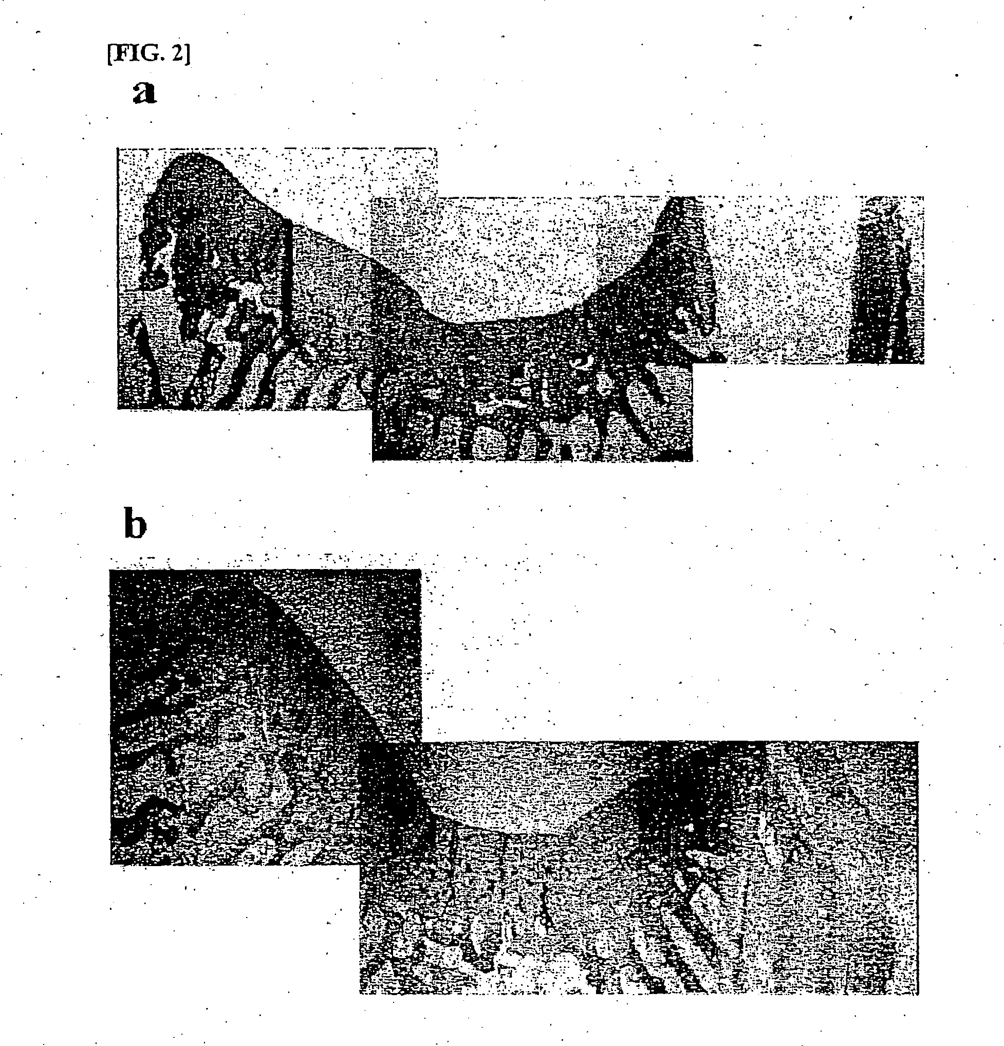 Composition for treatment of articular cartilage damage