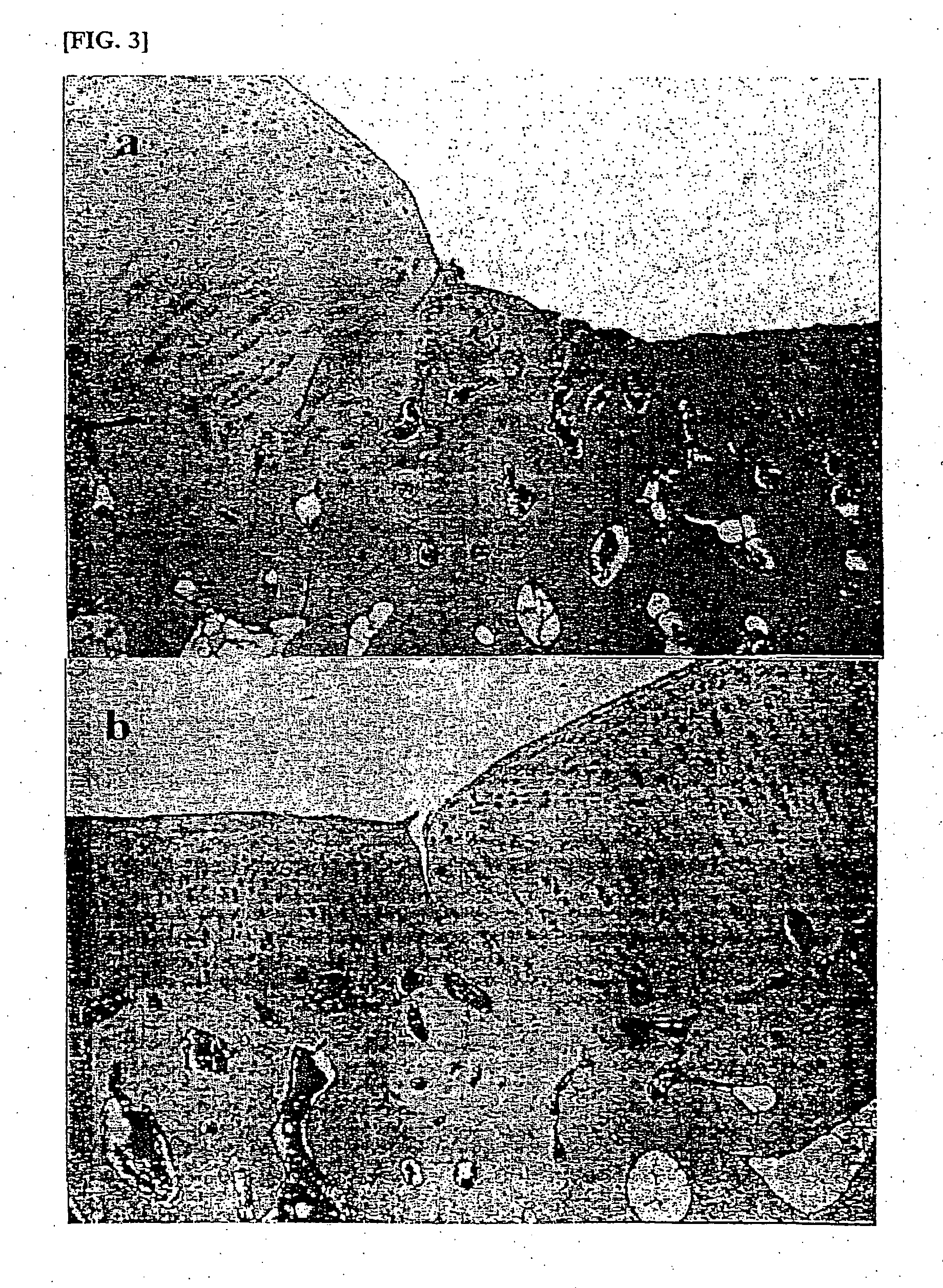 Composition for treatment of articular cartilage damage