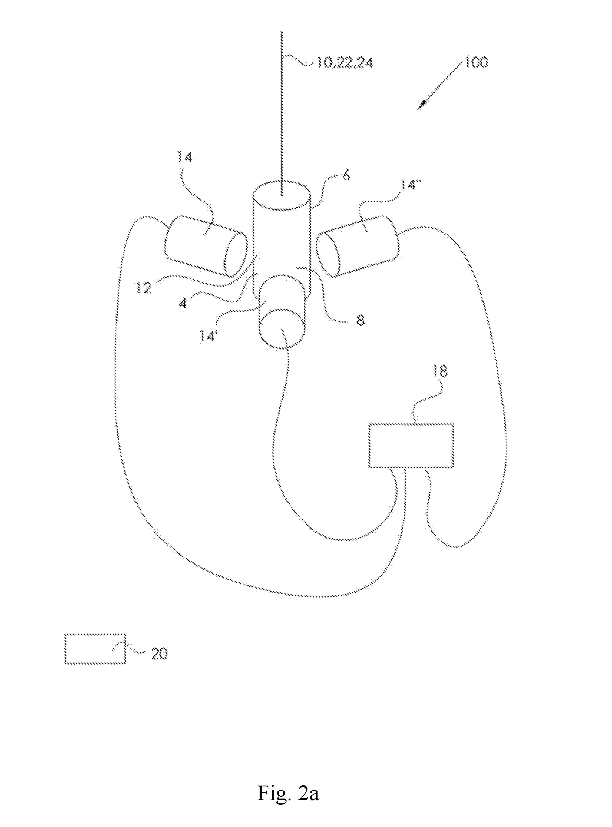 System for Detection of Foundation Movement in a Wind Turbine