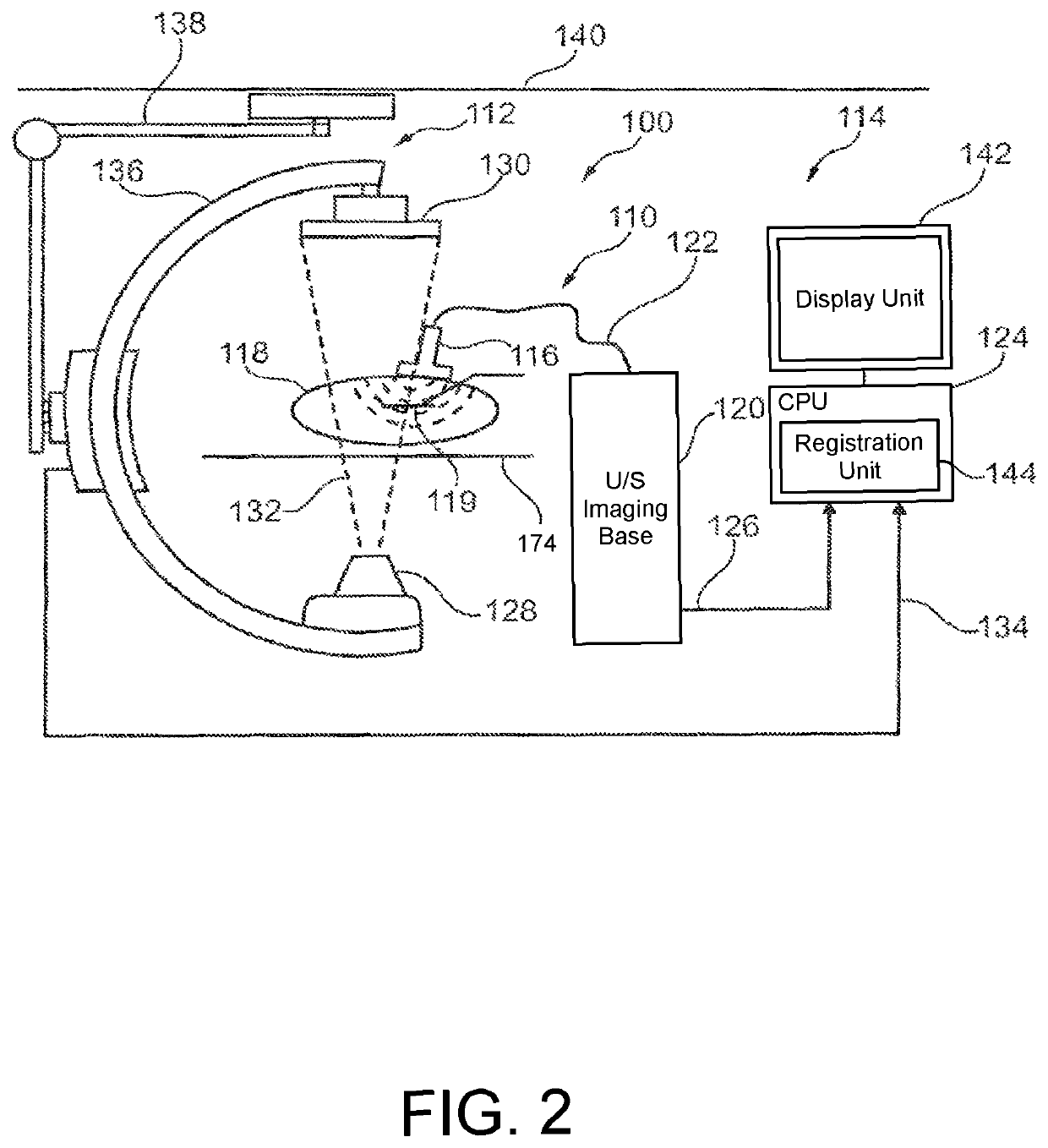 Enhancing ultrasound images