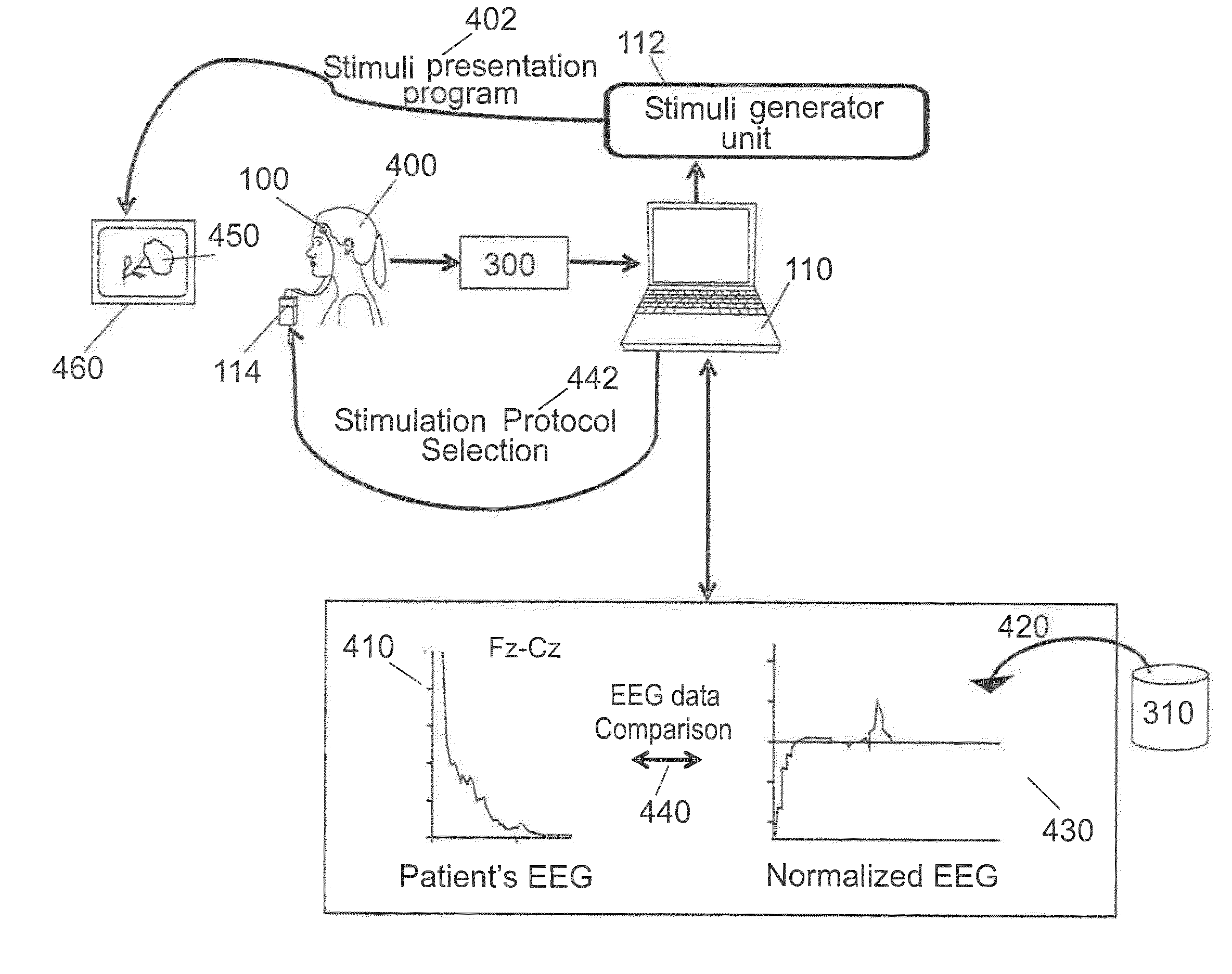 Brain therapy system and method using noninvasive brain stimulation