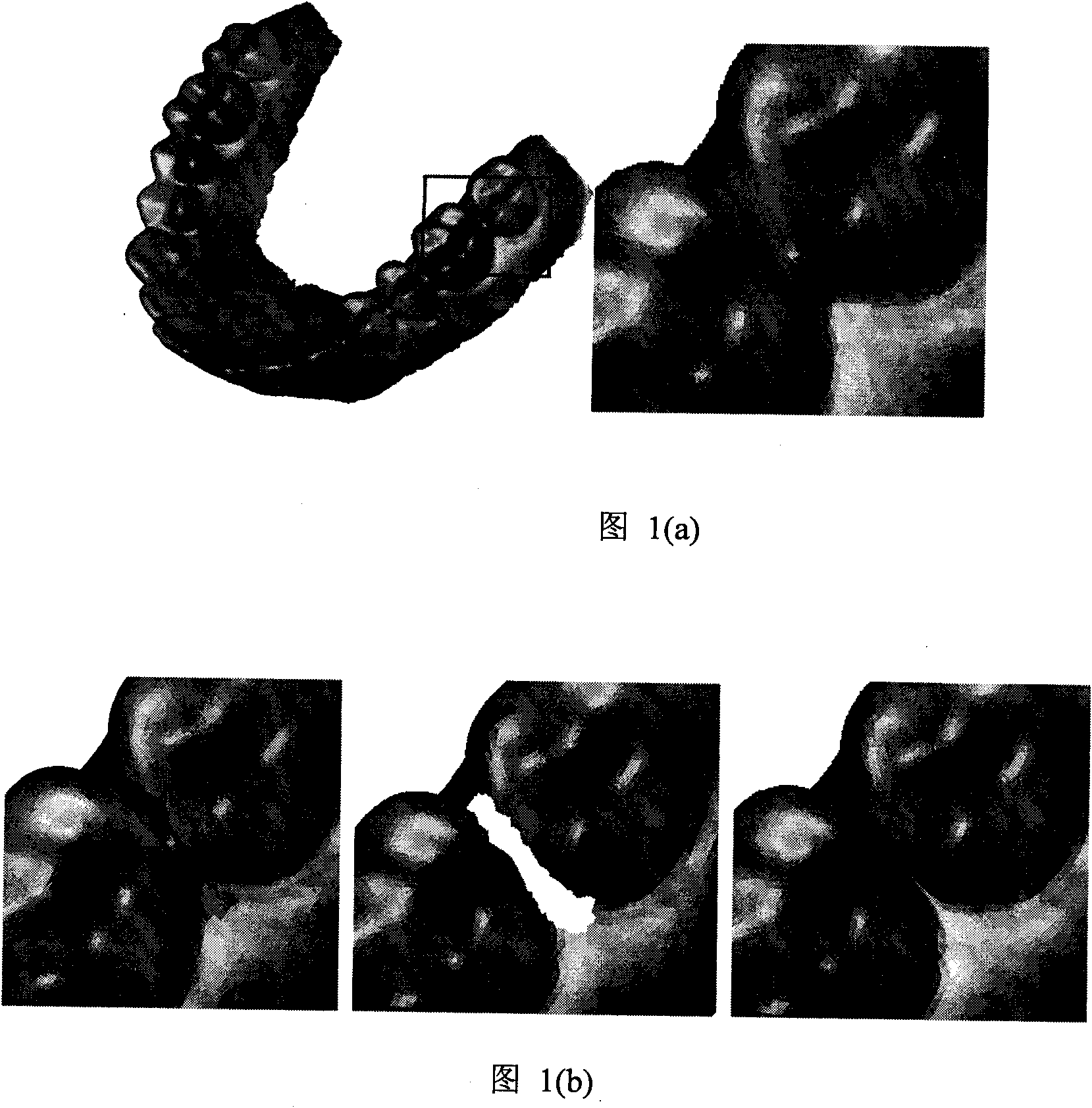 Method for accurately recovering single tooth form on three-dimensional tooth-mandible model