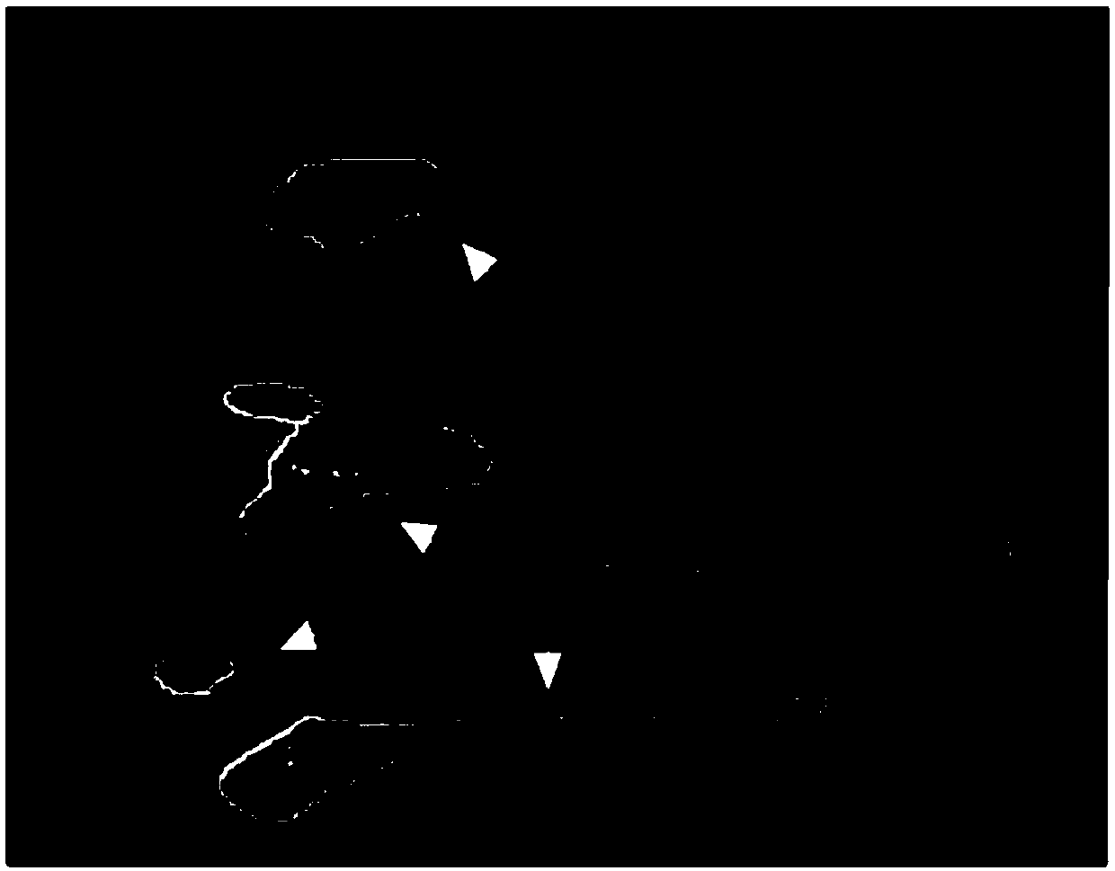 Tumor cell heterogeneic transplantation zebrafish model, construction method and application thereof