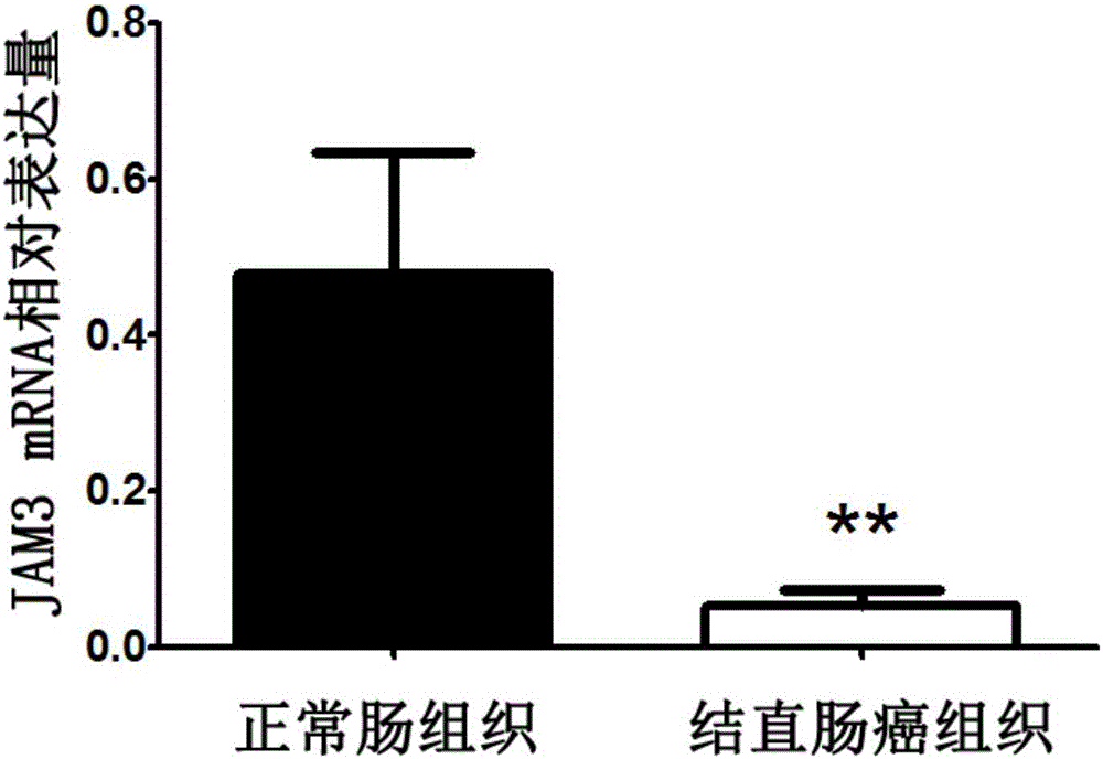 Application of JAM3 gene to preparation of colorectal cancer diagnosis kit and kit