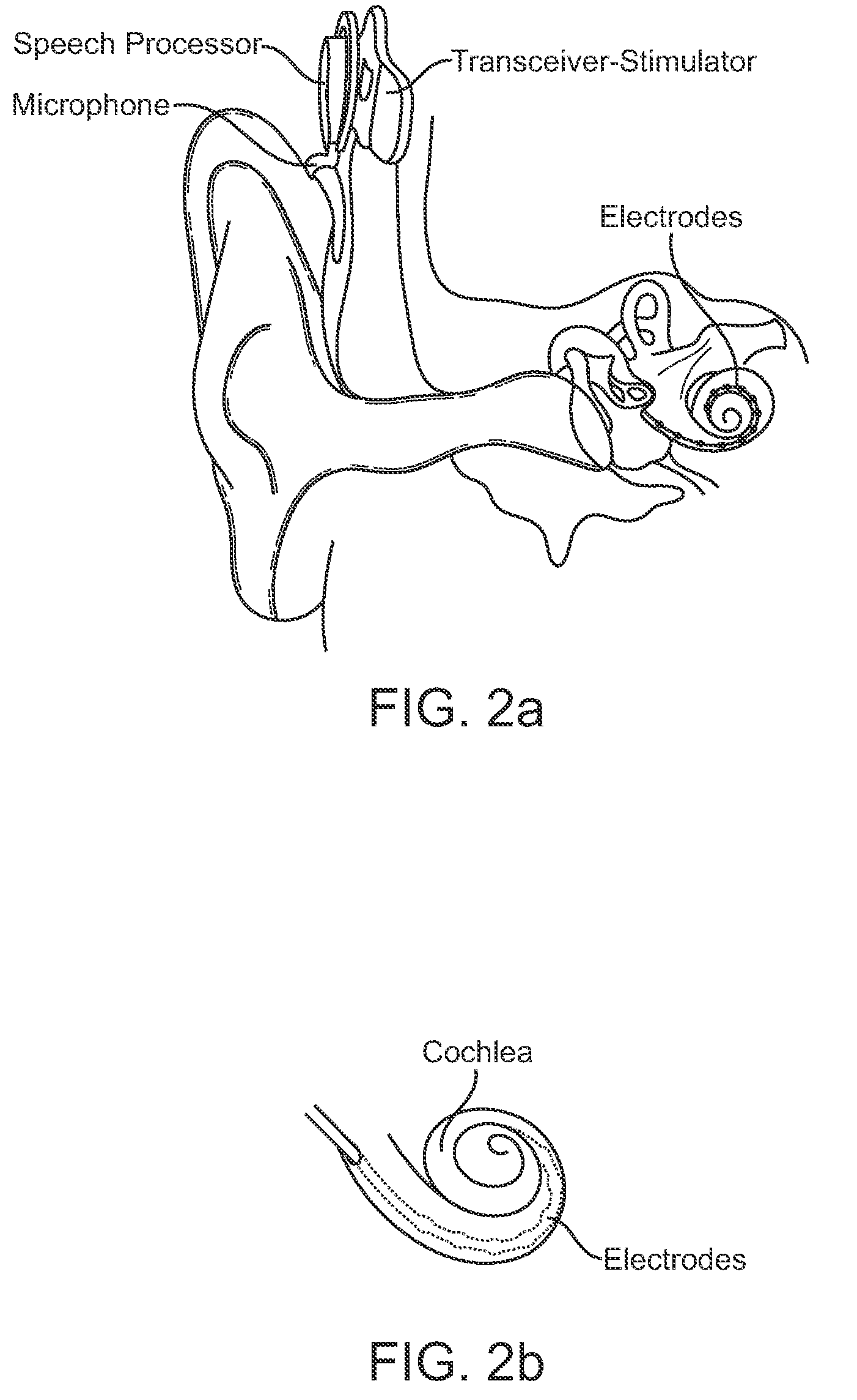 Systems and methods for implantable leadless cochlear stimulation