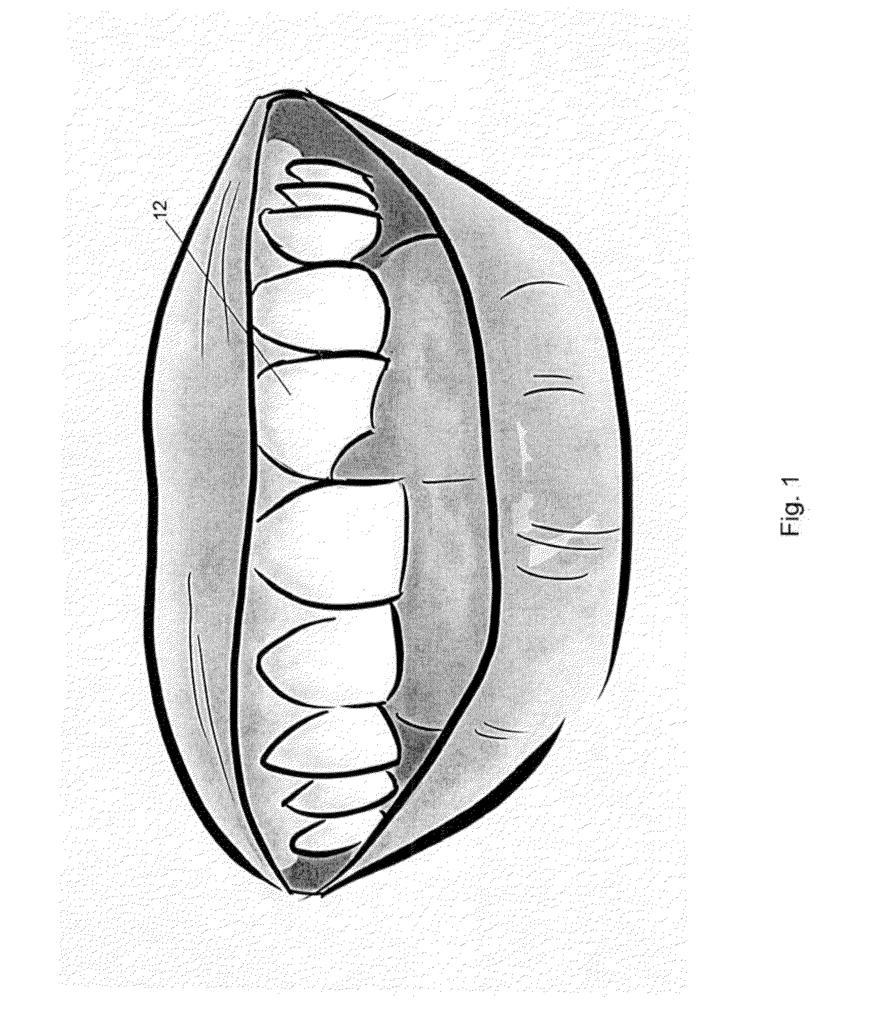 System and Method for Customized Anatomical Implant Prosthetic Pieces