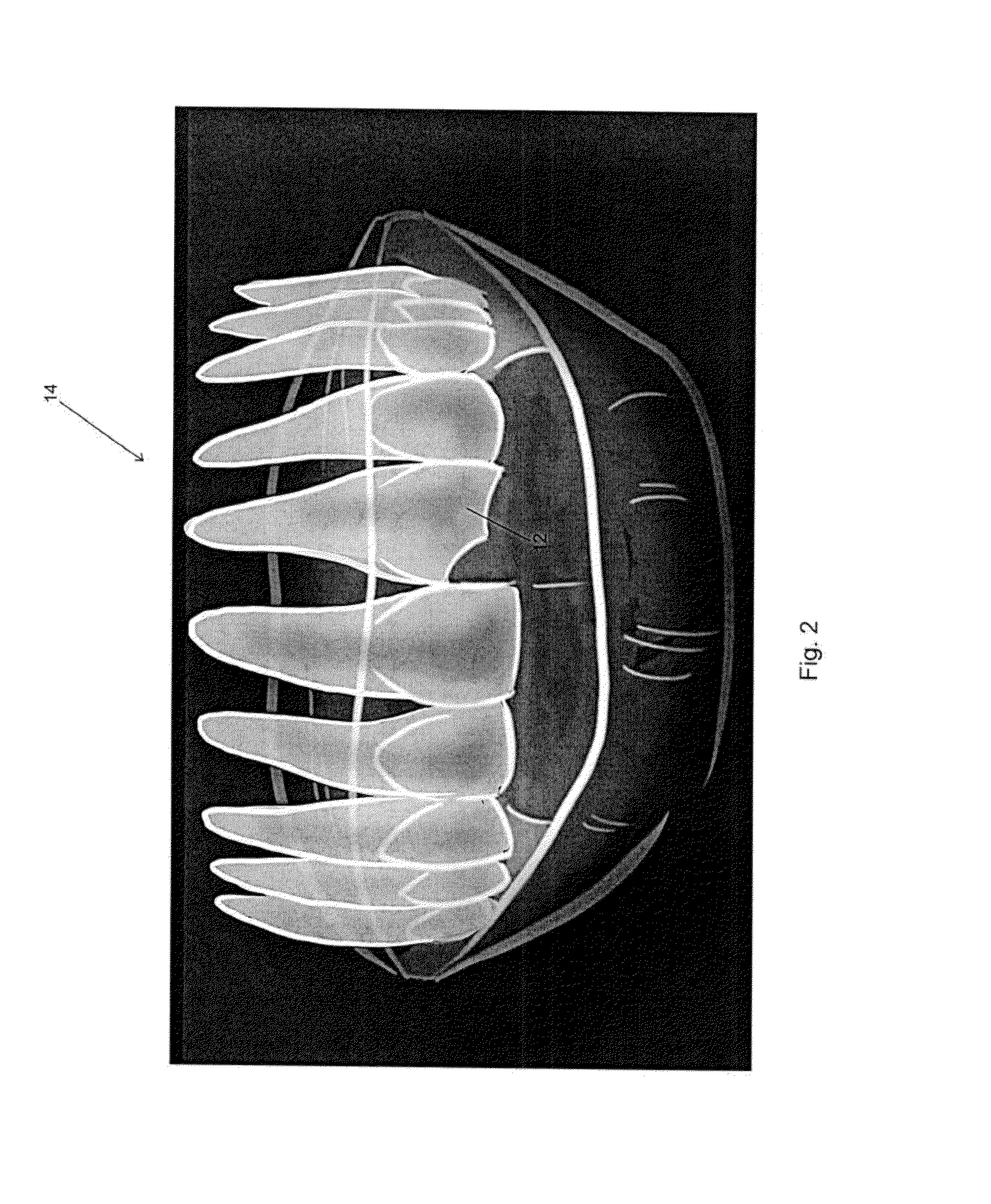 System and Method for Customized Anatomical Implant Prosthetic Pieces