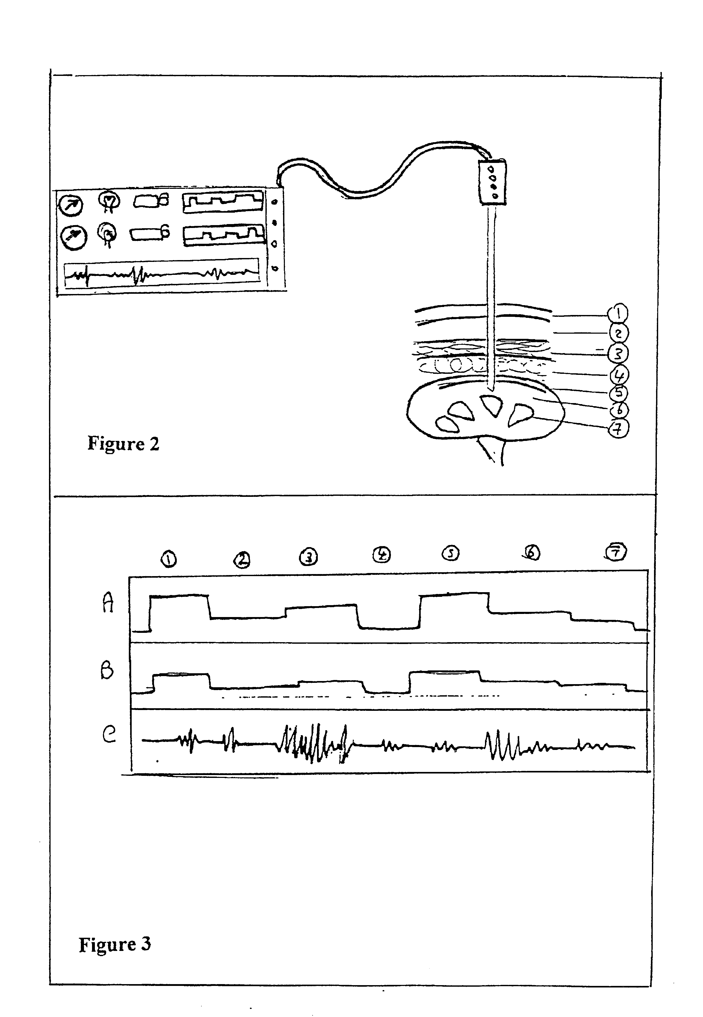 Detector of living tissue strength and electrical resistance and activity