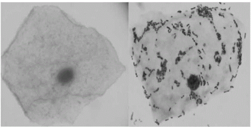 Lactobacillus jensenii and pharmaceutical application thereof