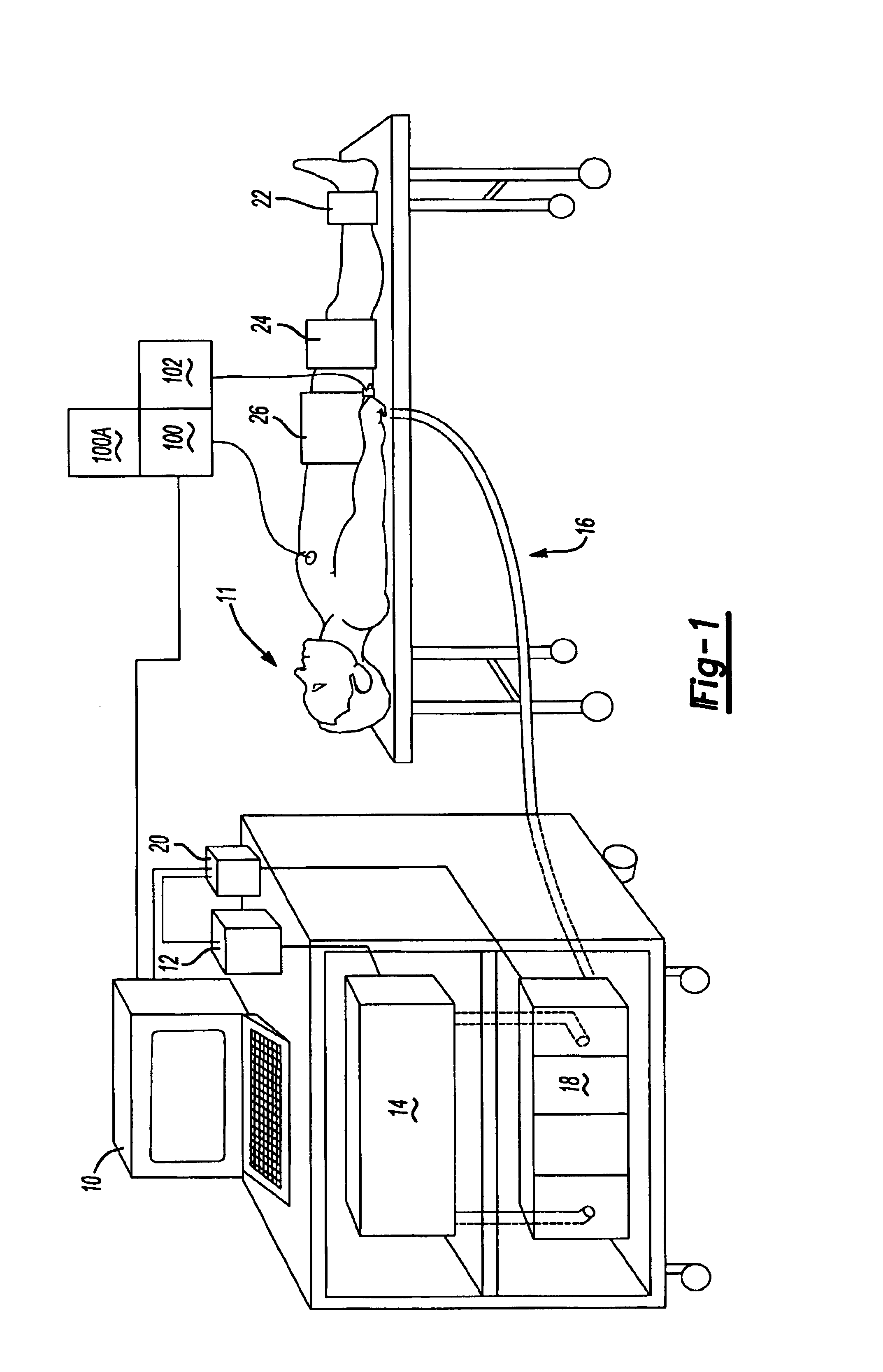 Computer-based control for a counterpulsation device using noncompressed air