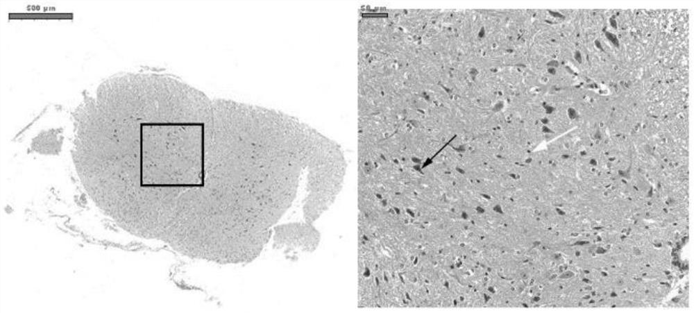 Method for diagnosing spinal cord injury and screening spinal cord injury treatment medicine