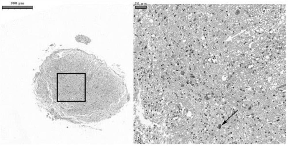 Method for diagnosing spinal cord injury and screening spinal cord injury treatment medicine