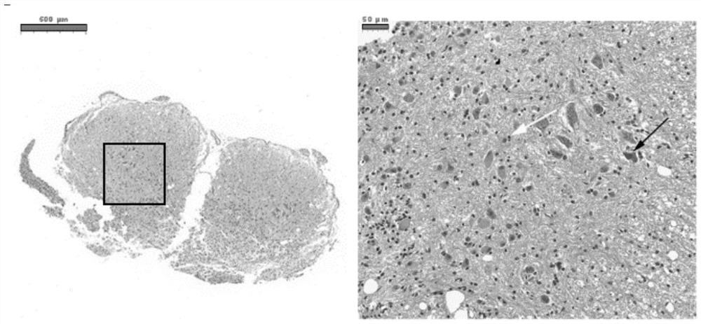 Method for diagnosing spinal cord injury and screening spinal cord injury treatment medicine