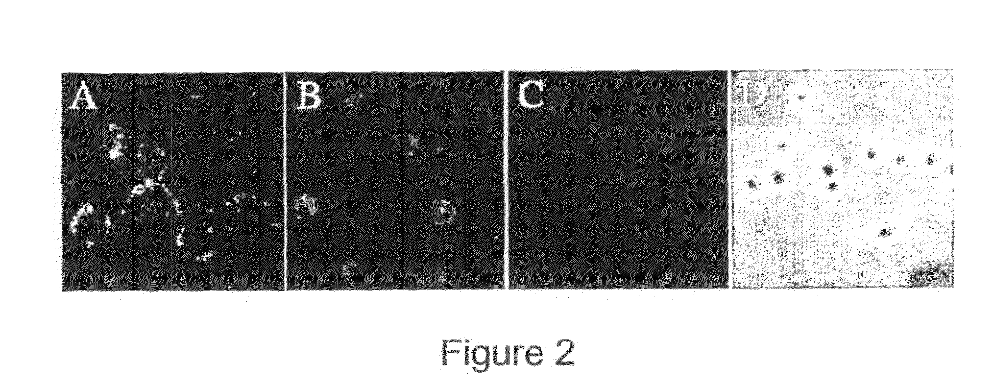 Method of inhibiting infection by HCV, other flaviviridae viruses, and any other virus that complexes to low density lipoprotein or to very low density lipoprotein in blood preventing viral entry into a cell