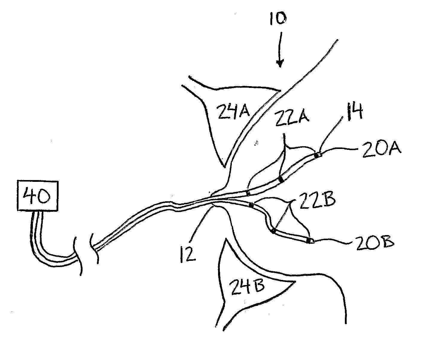 System and Micro-Catheter Devices for Medical Imaging of the Breast