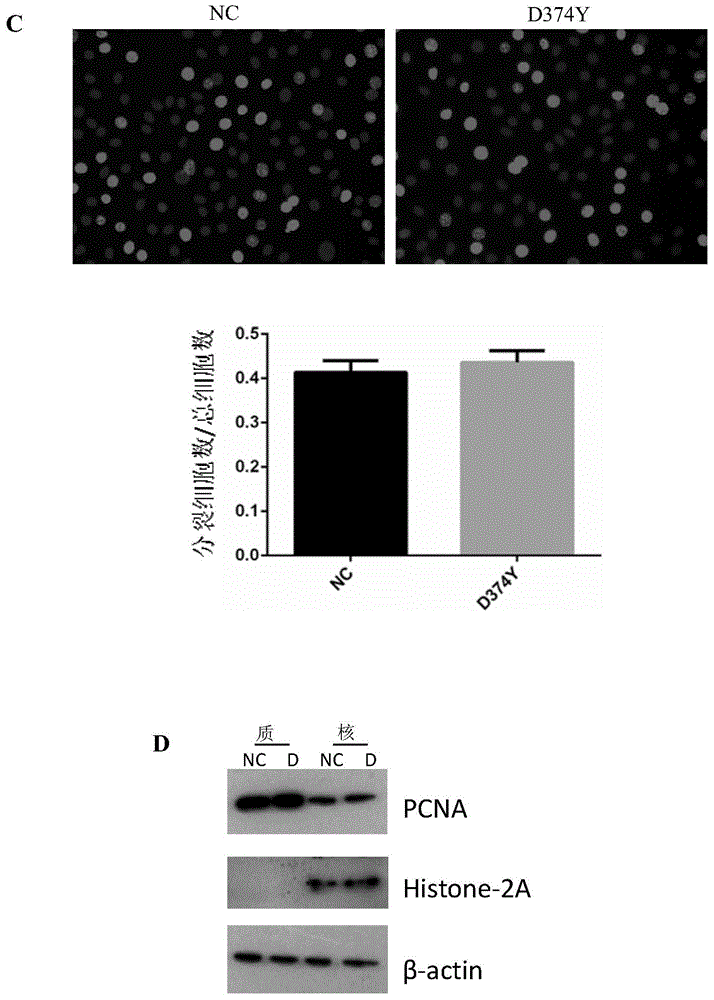 Application of D374Y mutant of PCSK9 protein in hepatoma cell migration restraining