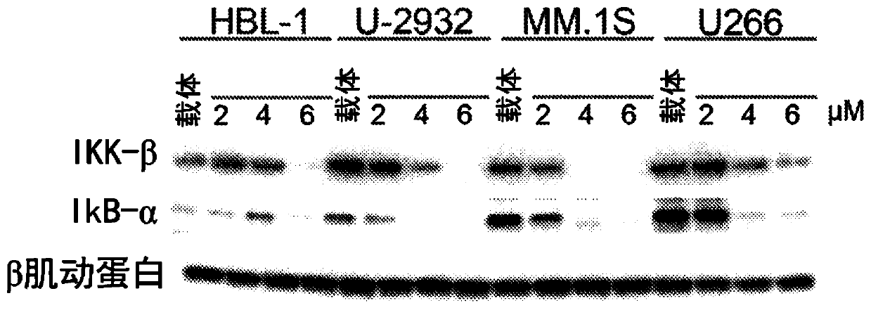 Treatment of hematological malignancy with small molecule nf-kb inhibitors